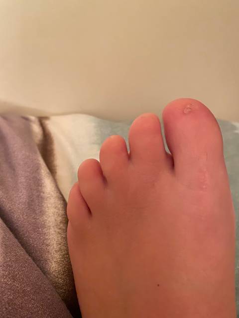 NoNailsfeet OnlyFans – free nudes, naked, leaked